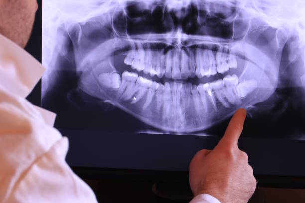 Best Emergency Treatment for Toothache in Salem, SD