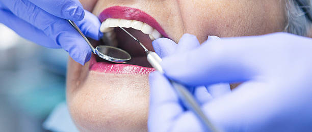 Best Emergency Tooth Extraction in Salem, SD